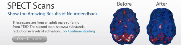 SPECT Scans - Show amazing results through neurofeedback SPECT Scans - Show amazing results through neurofeedback